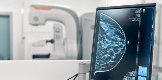 آنالیز تصاویر ماموگرافی توسط هوش مصنوعی در بیمارستان امام خمینی
