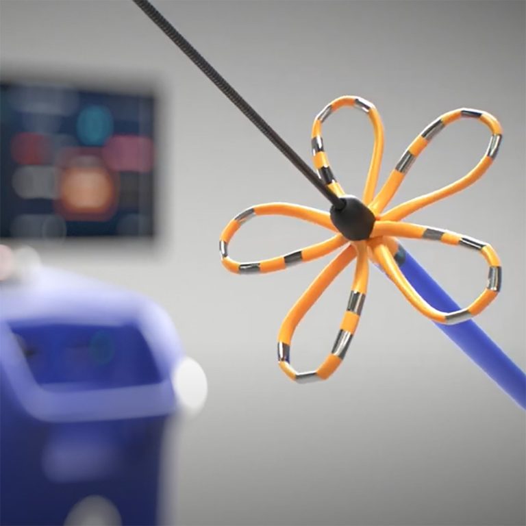 دستگاه FARAPULSE برای درمان نوعی بیماری قلبی تایید شد