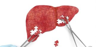 عملکرد موفقیتآمیز داروی آزمایشی survodutide در درمان نوعی بیماری کبدی