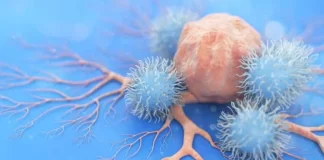 داروی Elahere برای مبتلایان به نوعی سرطان تخمدان تاییدیه کامل دریافت کرد