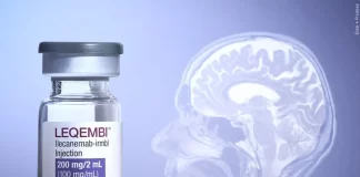 داروی آلزایمر لِکمبی در آمریکا با شک و تردید پزشکان روبرو شد