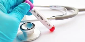 رفع انحصار فاکتور ۸ و رسیدن به شرایط پایداری این دارو