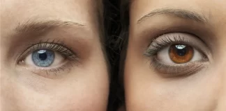 عوارض خطرناک جراحی زیبایی تغییر رنگ چشم