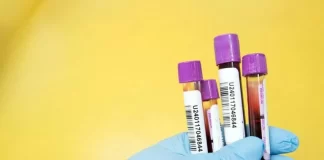 حمایت مشاوران FDA از آزمایش خون Shield برای تشخیص سرطان روده بزرگ