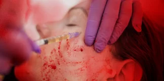 روش زیبایی vampire facial منجر به ابتلای ۳ زن به اچآیوی شد