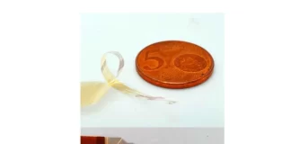 عدم نیاز به جراحی مغز با ایمپلنت کوچکی که در اطراف نخاع پیچیده میشود