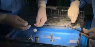 اولین بیماران در بریتانیا دستگاهی انقلابی برای توقف رفلاکس اسید و سوزش سر دل دریافت کردند