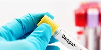 تامین کیت تشخیص سریع تب دنگی در کشور