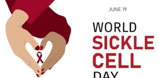 ۱۹ ژوئن؛ روز جهانی سلول داسیشکل