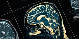 دومین داروی آلزایمر مورد تایید FDA قرار گرفت