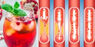 ۶ آبمیوه قرمز برای کمک به درمان گرفتگی رگهای قلب