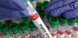 اسپانیا/  اهدای  ۵۰۰ هزار دُز واکسن امپاکس برای مبارزه با شیوع این بیماری