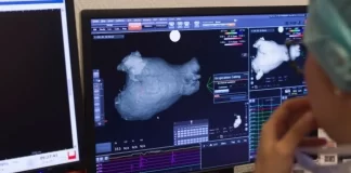 داروی Amvuttra مرگومیر ناشی از بیماریهای نادر قلبی را کاهش میدهد