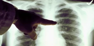 داروی آزمایشی  invonescimab در رقابت با کیتردا قرار گرفت