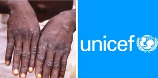 برگزاری مناقصه اضطراری برای تامین واکسنهای امپاکس