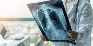 عملکرد امیدوارکننده واکسن پنوموکوک آزمایشی VAX-۳۱ در مطالعات اولیه