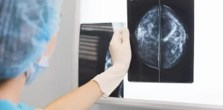 عملکرد موفق یک داروی ترکیبی در مبتلایان به نوعی سرطان پستان پیشرفته