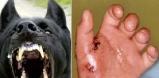 مرگ ۱۸ نفر بر اثر هاری در کشور در سال ۱۴۰۲