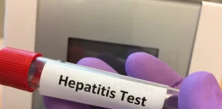 ایران در گروه کشورهای با شیوع بسیار پایین هپاتیت