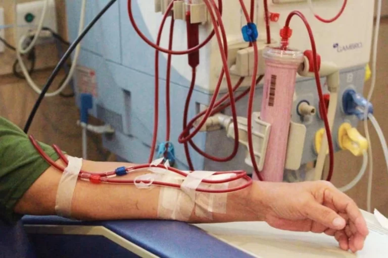 آمار فوتی‌های بیماران دیالیزی صفاقی در اثر محلول آلوده به آلومینیوم به ۷۰ نفر رسید