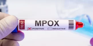 افزایش ۵۰۰ درصدی موارد امپاکس در آفریقا نسبت به سال ۲۰۲۳