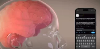 کانادا/ انتخاب ۶ بیمار کوادری پلژی برای مطالعه تراشه مغزی ایلان ماسک