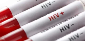 درمان بیماری ایدز در کشور رایگان است