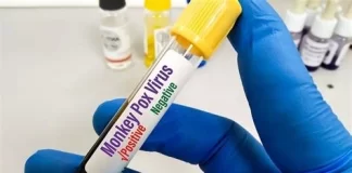 فعالان جهانی سلامت، خواستار کاهش نرخ تستهای امپاکس