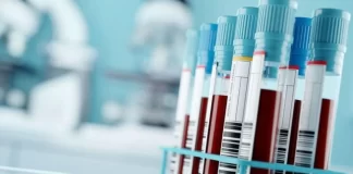 ابوظبی/ معرفی تست بیوپسی مایع برای غربالگری سرطان روده بزرگ