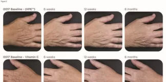 نتایج یک مطالعه کلینیک مایو: ۲ محصول بدون نسخه برای پیری پوست دست بهتر از درمانهای گرانقیمت عمل میکنند