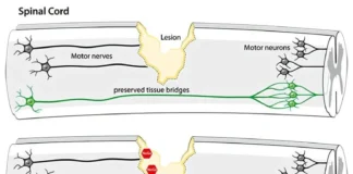داروی آزمایشی آنتیبادی NG ۱۰۱ نویدبخش ترمیم آسیبهای نخاعی است