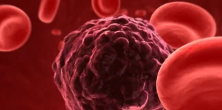 افزایش موارد سرطان در ایران نزدیک به دو برابر متوسط جهانی