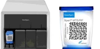 نخستین تست تشخیص سل مورد تایید سازمان جهانی بهداشت قرار گرفت