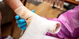 ۱۱۵۶ کیلوگرم پانسمان بیماران پروانهای ترخیص شد