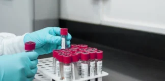 آزمایش خون مبتنی بر هوش مصنوعی نخستین نشانه سرطان پستان را تشخیص داد