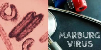 تایید شیوع ویروس ماربورگ در تانزانیا