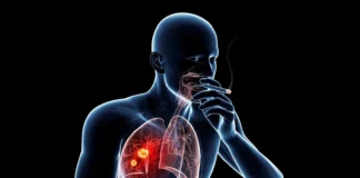 ریسک ابتلا به انواع سرطانها با مصرف سیگار