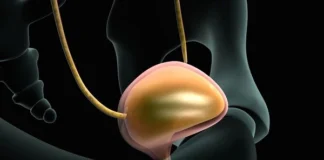 سرطان مثانه در کمین سیگاریها