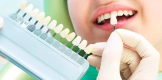 سرپرست دفتر سلامت دهان و دندان معاونت بهداشت وزارت بهداشت: درمانهای زیبایی دندان عموما توصیه نمیشوند