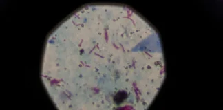 شیوع عمده سل در کانزاسسیتی