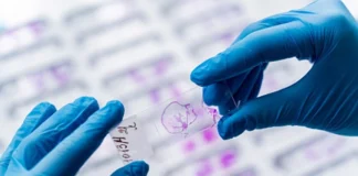 یک دستگاه جدید نویدبخش تشخیص سرطان دهان در مرحله زودهنگام