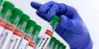 آنالیز نمونههای فاضلاب هواپیماها، راهکاری برای پیشگیری از شیوع امپاکس در امارات