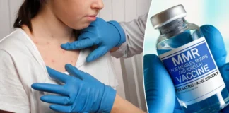 تعداد مبتلایان به سرخک در آمریکا به ۹۳ مورد در ۲۰۲۵ افزایش یافت