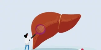 وخیمتر شدن وضعیت کبد چرب با مصرف بیرویه داروهای مسکن و گیاهی نامعتبر