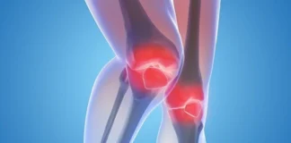 چه عواملی خطر ابتلا به آرتروز زانو را افزایش میدهند؟