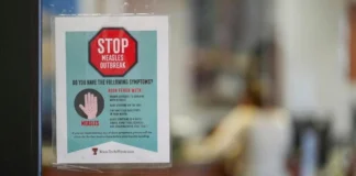 موارد ابتلا به سرخک در تگزاس و نیومکزیکو به ۳۷۰ نفر رسید