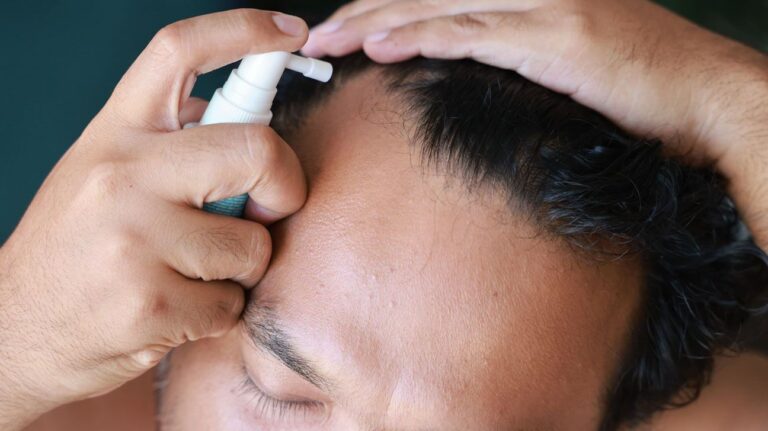 هشدار FDA درخصوص عوارض جانبی محصول فیناستراید فاقد تاییدیه هشدار FDA درخصوص عوارض جانبی محصول فیناستراید فاقد تاییدیه