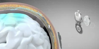 پروژه تراشه مغزی چینی پس از نخستین موفقیت به مطالعات انسانی سرعت بخشید