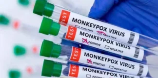 افزایش موارد ابتلا به امپاکس در آفریقا