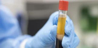 لزوم تولید داروهای مشتق از پلاسما در داخل کشور و کاهش وابستگی به واردات